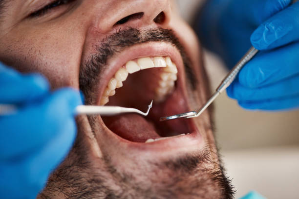 Best Urgent Care for Lost Fillings or Crowns in Glendale, AZ